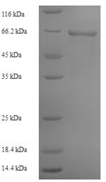 Bacteroides vulgatus Alpha-1,3-galactosidase B (glaB1) Recombinant Protein, Bacteroides vulgatus (strain ATCC 8482 / DSM 1447 / JCM 5826 / NBRC 14291 / NCTC 11154), Yeast, N-terminal 6xHis-tagged, 67.0 kDa, purity >≥ 90% as determined by SDS-PAGE.