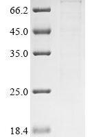Mouse Endoribonuclease ZC3H12A (Zc3h12a) Recombinant Protein - BioCrest Sci