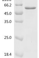 Plasmodium falciparum Merozoite surface protein 2 (MSP2), partial Recombinant Protein, C-GST - BioCrest Sci