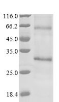 Human Adiponectin receptor protein 1 (ADIPOR1), partial Recombinant Protein - BioCrest Sci