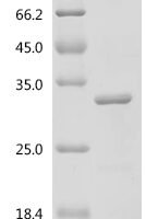 Mouse Fibroblast growth factor 21 (Fgf21) Recombinant Protein, C-His - BioCrest Sci