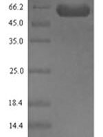 Arabidopsis thaliana Geranylgeranyl diphosphate reductase, chloroplastic (CHLP) Recombinant Protein - BioCrest Sci