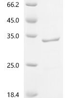 Human Pulmonary surfactant-associated protein A1 (SFTPA1) Recombinant Protein, C-His - BioCrest Sci