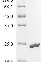 Escherichia coli Nucleoside diphosphate kinase (ndk) Recombinant Protein - BioCrest Sci