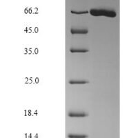 Mouse Albumin (Alb) Recombinant Protein - BioCrest Sci