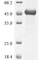 Rat Macrophage colony-stimulating factor 1 (Csf1), partial Recombinant Protein - BioCrest Sci
