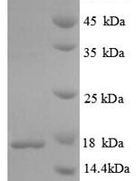 Mycobacterium tuberculosis Immunogenic protein MPT63 (mpt63) Recombinant Protein - BioCrest Sci