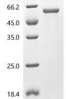 Bartonella henselae Type IV secretion system protein virB4 (virB4), partial Recombinant Protein - BioCrest Sci