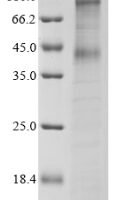 Human Mu-type opioid receptor (OPRM1) Recombinant Protein - BioCrest Sci