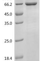 Human Patatin-like phospholipase domain-containing protein 2 (PNPLA2) Recombinant Protein - BioCrest Sci