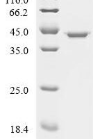 Human Fructose-bisphosphate aldolase A (ALDOA) Recombinant Protein, N-His/C-Myc - BioCrest Sci