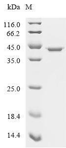 Human Fructose-bisphosphate aldolase A (ALDOA) Recombinant Protein, N-His/C-Myc, Homo sapiens (Human), E.coli, N-terminal 6xHis-tagged and C-terminal Myc-tagged, 41.3 kDa, purity >≥ 95% as determined by SDS-PAGE.