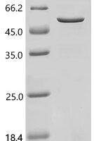 Human Adenylate cyclase type 3(ADCY3),partial Recombinant Protein - BioCrest Sci