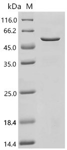 Human Adenylate cyclase type 3(ADCY3),partial Recombinant Protein, Homo sapiens (Human), E.coli, N-terminal 6xHis-SUMO-tagged, 51.4 kDa, purity >≥ 85% as determined by SDS-PAGE.