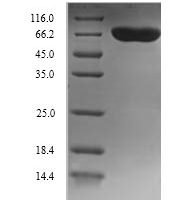 Human Dopamine beta-hydroxylase (DBH), partial Recombinant Protein, N-His, aa 40–617, Yeast - BioCrest Sci