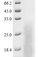 Macrovipera lebetina Chymotrypsin-like protease VLCTLP Recombinant Protein, C-His - BioCrest Sci
