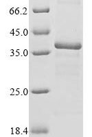 Burkholderia cepacia Phthalate dioxygenase reductase (ophA1) Recombinant Protein - BioCrest Sci