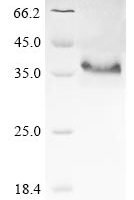 Human Interleukin-32 (IL32) Recombinant Protein, N-His-SUMOstar - BioCrest Sci