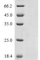 Human C-C motif chemokine 1 (CCL1) Recombinant Protein, N-10His-HA, aa 24–96, E.coli - BioCrest Sci