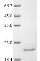 Human Interferon alpha-16 (IFNA16) Recombinant Protein - BioCrest Sci