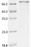 Human Calcium-activated chloride channel regulator 1 (CLCA1), partial Recombinant Protein, C-His, aa 22–695 - BioCrest Sci