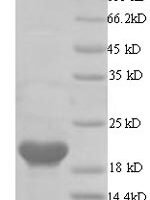 Human papillomavirus type 16 Protein E6 (E6) Recombinant Protein, N-His, aa 1–158, Yeast - BioCrest Sci