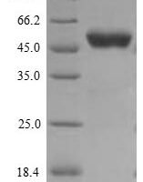 Human G2/mitotic-specific cyclin-B1 (CCNB1) Recombinant Protein, N-His - BioCrest Sci