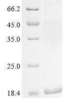 Human Sarcolipin (SLN) Recombinant Protein - BioCrest Sci