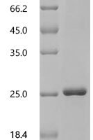 Macaca mulatta Interleukin-2 (IL2) Recombinant Protein, C-His - BioCrest Sci
