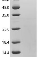 Human Pro-epidermal growth factor (EGF), partial Recombinant Protein, C-10His - BioCrest Sci