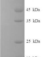 Human RAF proto-oncogene serine/threonine-protein kinase (RAF1) Recombinant Protein, N-His-SUMO - BioCrest Sci