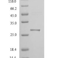 Mouse Hepatitis A virus cellular receptor 1 homolog (Havcr1), partial Recombinant Protein - BioCrest Sci