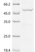 Tick-borne encephalitis virus Far Eastern subtype Genome polyprotein, partial Recombinant Protein, C-10His - BioCrest Sci