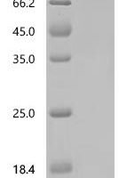Human Seizure protein 6 homolog (SEZ6), partial Recombinant Protein, N-HSA/C-10His, aa 592–704 - BioCrest Sci