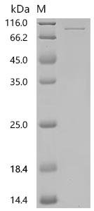Human Seizure protein 6 homolog (SEZ6), partial Recombinant Protein, N-HSA/C-10His, aa 592–704, Homo sapiens (Human), Mammalian cell, N-terminal HSA-tagged and C-terminal 10xHis-tagged, 80.5 kDa, purity >≥ 95% as determined by SDS-PAGE.≥ 95% as determined by SEC-HPLC.