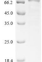 Severe acute respiratory syndrome coronavirus 2 Replicase polyprotein 1ab (rep), partial Recombinant Protein, C-His - BioCrest Sci