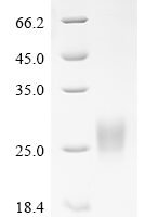 Human Pancreatic adenocarcinoma up-regulated factor (ZG16B) Recombinant Protein - BioCrest Sci