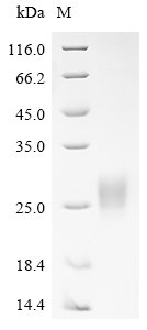 Human Pancreatic adenocarcinoma up-regulated factor (ZG16B) Recombinant Protein, Homo sapiens (Human), Mammalian cell, C-terminal hFc1-tagged, 46.1 kDa, purity >≥ 90% as determined by SDS-PAGE.