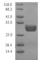 Penicillium citrinum Nuclease P1 Recombinant Protein, N-His, aa 1–270, Yeast - BioCrest Sci