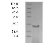 Sudan ebolavirus Envelope glycoprotein (GP), partial Recombinant Protein, N-His-Myc - BioCrest Sci