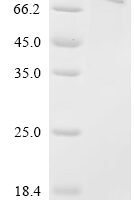 Crimean-Congo hemorrhagic fever virus Envelopment polyprotein (GP), partial Recombinant Protein, C-His - BioCrest Sci