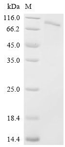 Crimean-Congo hemorrhagic fever virus Envelopment polyprotein (GP), partial Recombinant Protein, C-His, Crimean-Congo hemorrhagic fever virus (strain Nigeria/IbAr10200/1970) (CCHFV), E.coli, C-terminal 6xHis-tagged, 73.9 kDa, purity >≥ 90% as determined by SDS-PAGE.