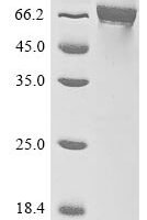 Crimean-Congo hemorrhagic fever virus Envelopment polyprotein (GP), partial Recombinant Protein, N-MBP/C-His - BioCrest Sci