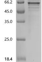 Human Chromogranin-A (CHGA) Recombinant Protein, N-His - BioCrest Sci