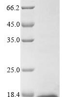 Macaca fascicularis Gamma-synuclein (SNCG) Recombinant Protein - BioCrest Sci