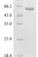 Human Taste receptor type 1 member 2 (TAS1R2), partial Recombinant Protein, C-His - BioCrest Sci
