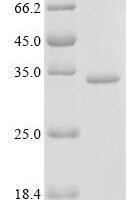 Human 28S rRNA (cytosine(4447)-C(5))-methyltransferase (NOP2), partial Recombinant Protein - BioCrest Sci