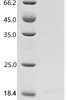 Human Disks large homolog 4 (DLG4) Recombinant Protein, C-10His - BioCrest Sci