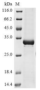 Bovine coronavirus Non-structural protein 2a (2a) Recombinant Protein, C-His, aa 1–278, strain LSU-94LSS-051, E.coli, Bovine coronavirus (strain LSU-94LSS-051) (BCoV-LSU) (BCV), E.coli, C-terminal 6xHis-tagged, 33.1 kDa, purity >≥ 85% as determined by SDS-PAGE.