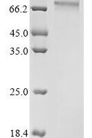 Human UPF0565 protein C2orf69 (C2orf69) Recombinant Protein, C-hFc1 - BioCrest Sci